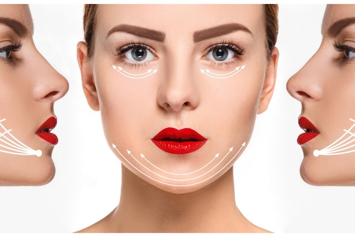 Căng da mặt bằng chỉ collagen có tốt không
