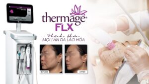 Làm Thermage Flx có tốt không