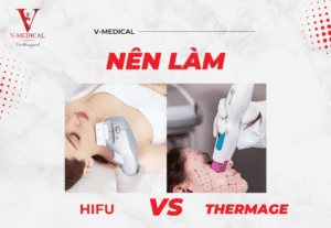 Nên làm Hifu hay Thermage