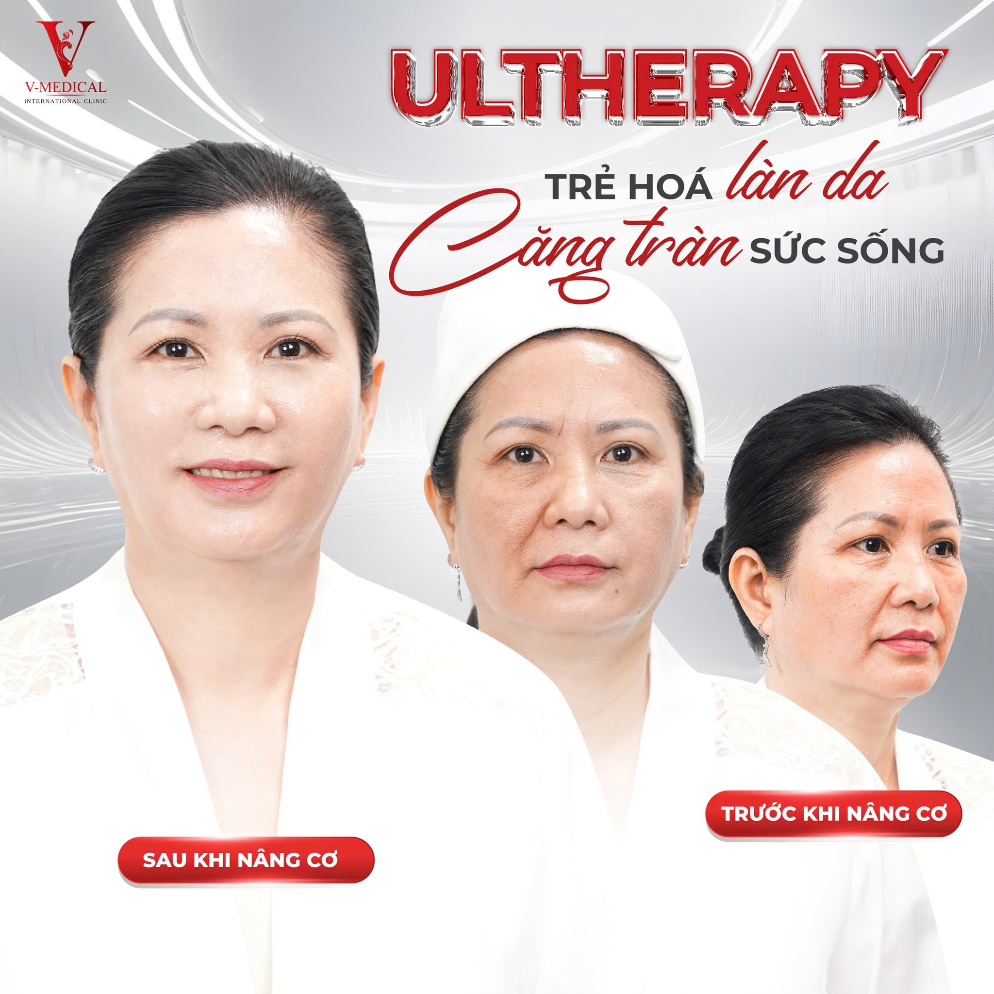 Làm ultherapy có hiệu quả không Làm ultherapy có hiệu quả không
