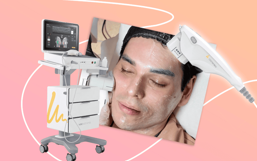 Cảm giác khi thực hiện nâng cơ bằng Ultherapy Prime