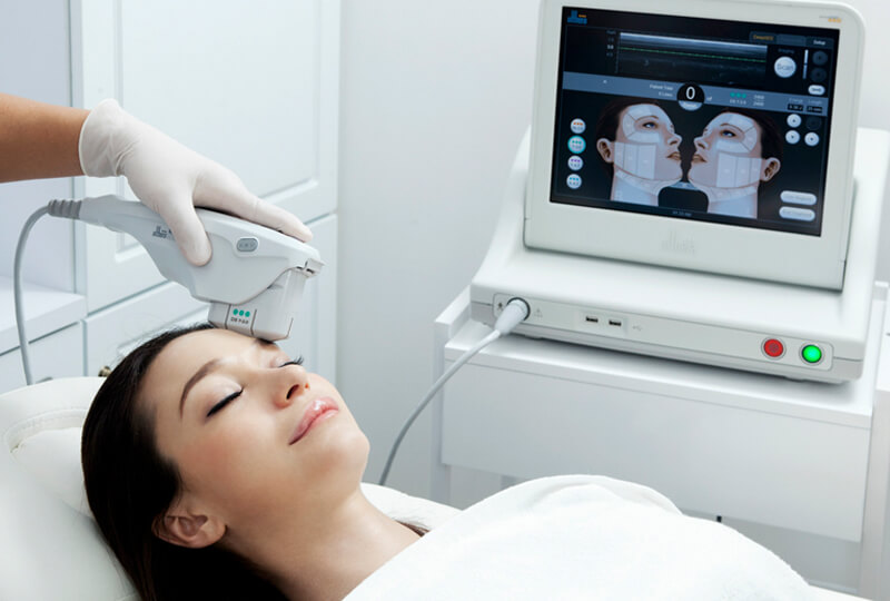 Hiệu quả trẻ hóa Ultherapy Prime