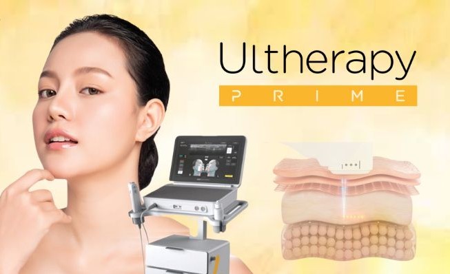 Nâng cơ bằng Ultherapy prime có đau không