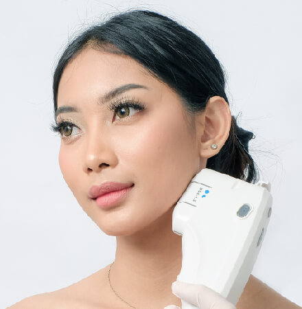 Trẻ hóa da Ultherapy Prime giúp làm thon gọn gương mặt