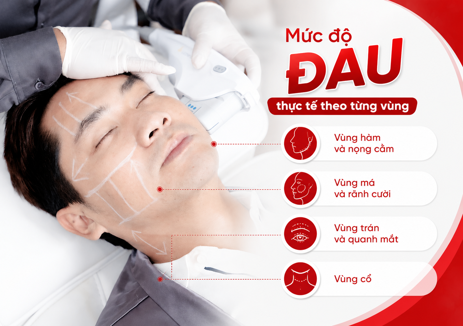 Ultherapy có đau không Ultherapy có đau không