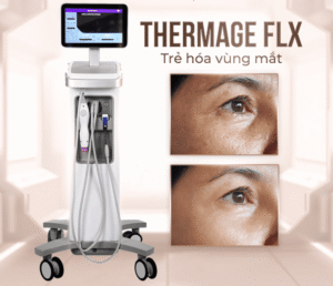 Thermage vùng mắt giúp trẻ hóa