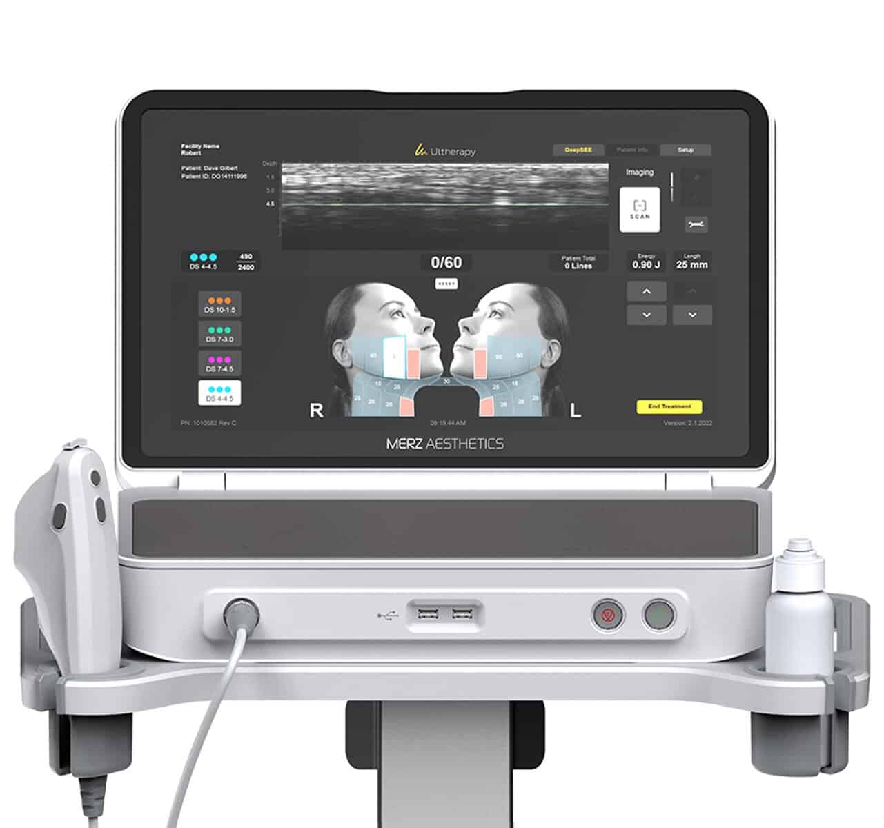 Ultherapy Prime nâng cơ có màn hình siêu âm real-time