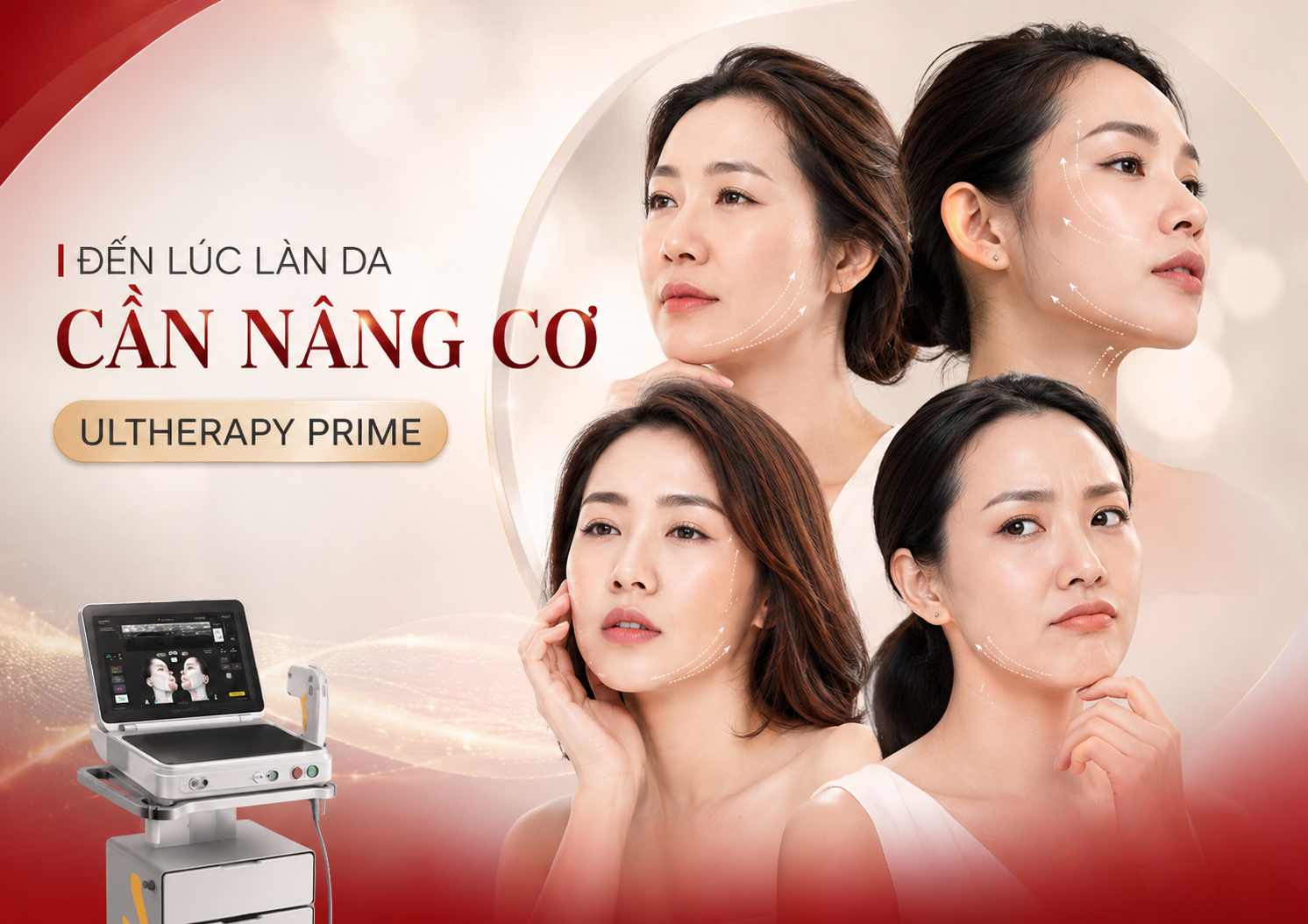 Làm Ultherapy Prime ở đâu tốt Làm Ultherapy Prime ở đâu tốt