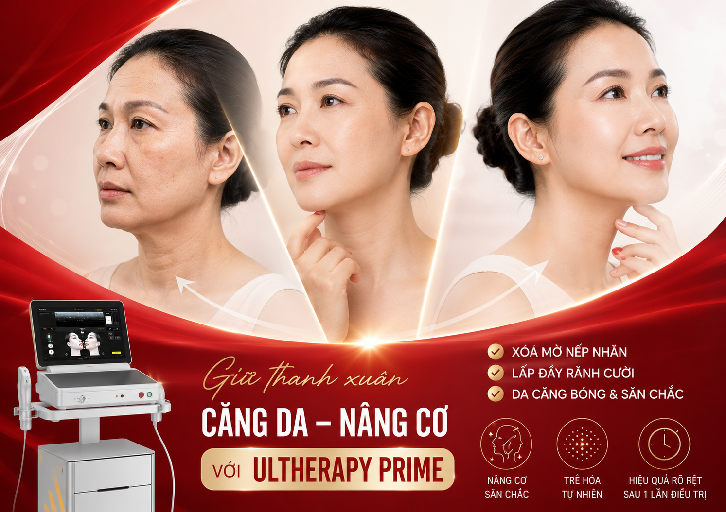 Làm Ultherapy Prime ở đâu tốt Làm Ultherapy Prime ở đâu tốt