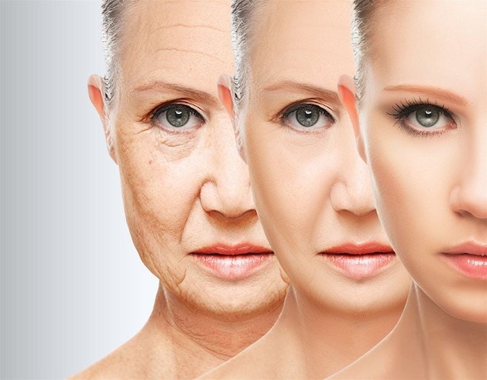 căng da mặt bằng chỉ collagen là gì