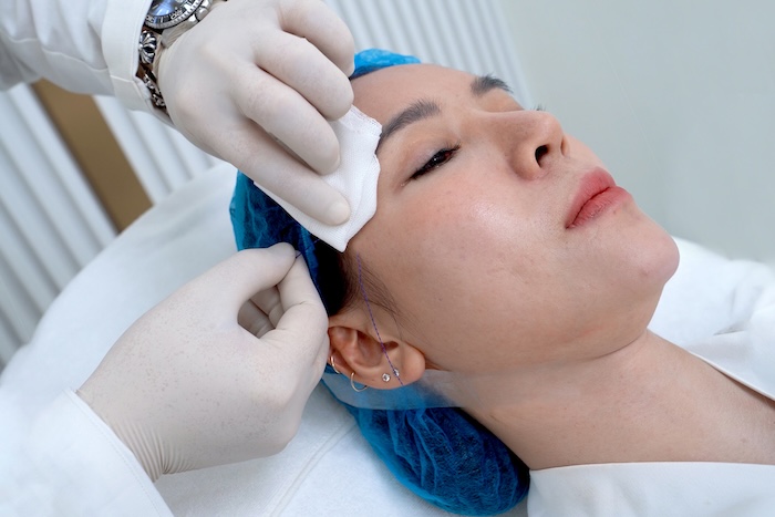 Phẫu thuật căng da mặt ở đâu