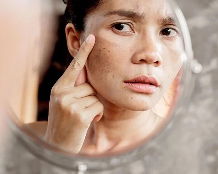 Thẩm mỹ viện căng da mặt