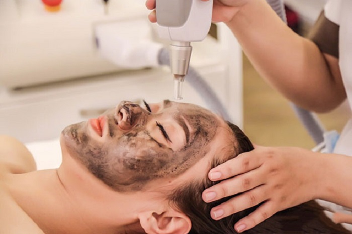 Bắn than hoạt tính trẻ hóa da