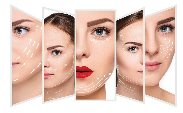 Các loại chỉ nâng cơ mặt