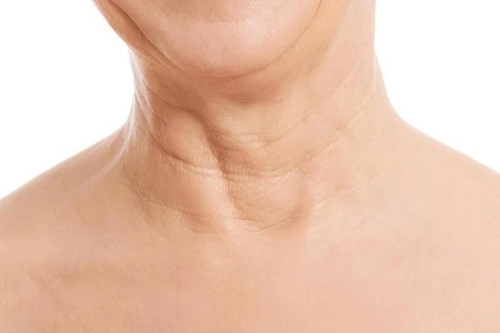Cách làm mờ nếp nhăn ở cổ