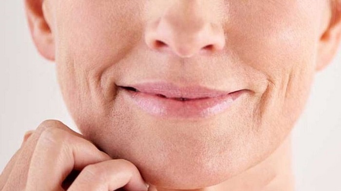 Cách xóa nếp nhăn vùng miệng