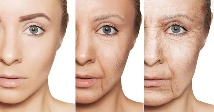 Chảy xệ cơ mặt