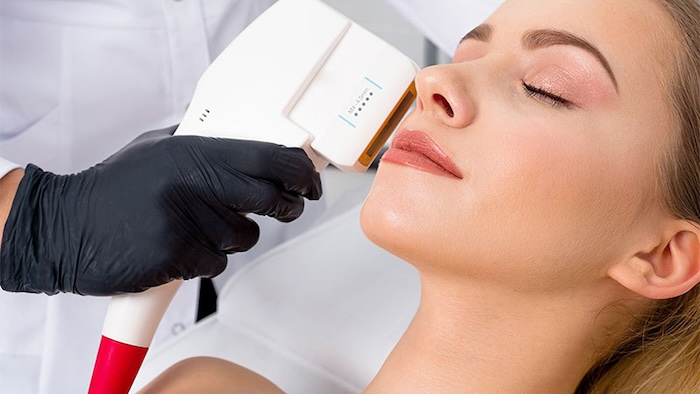 Chi phí nâng cơ hifu