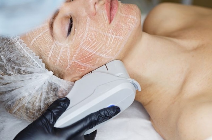 Công nghệ nâng cơ trẻ hóa