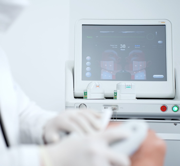 Công nghệ trẻ hóa da ultherapy