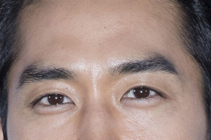 Đàn ông đuôi mắt có nhiều nếp nhăn