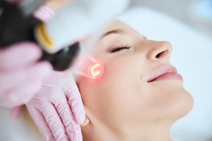 Điều trị trẻ hóa da bằng laser