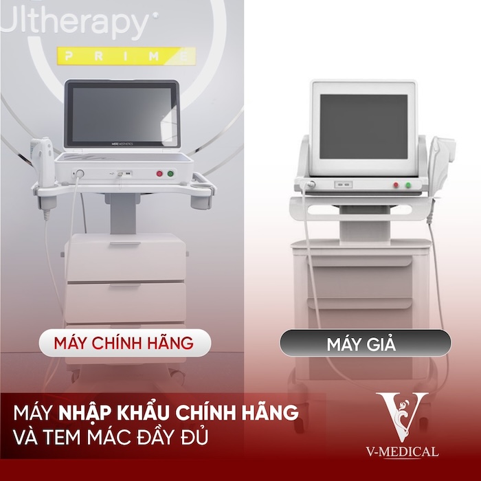 Giá nâng cơ mặt ultherapy