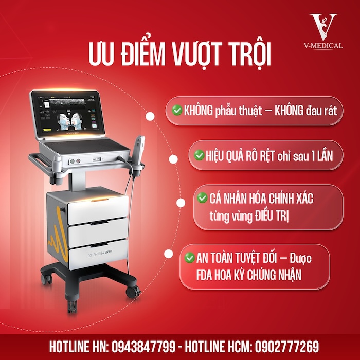 Giá nâng cơ mặt ultherapy
