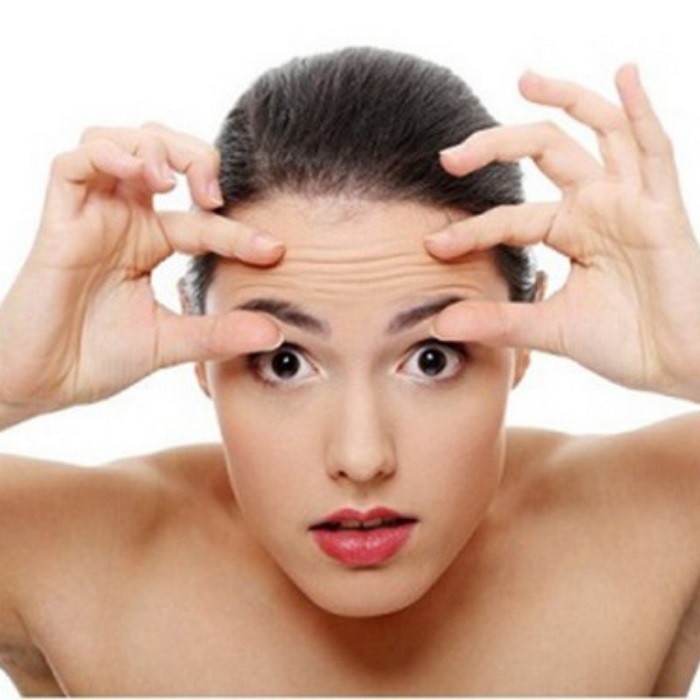 Giảm nếp nhăn vùng trán Giảm nếp nhăn vùng trán