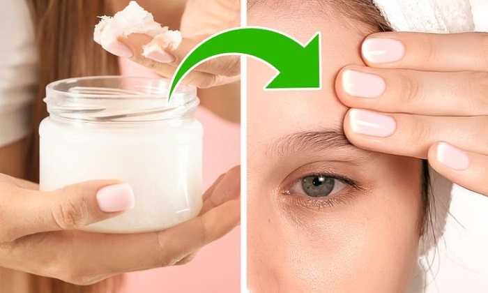 Kem trị nếp nhăn quanh mắt