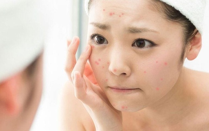 Mặt nạ giúp trẻ hóa làn da