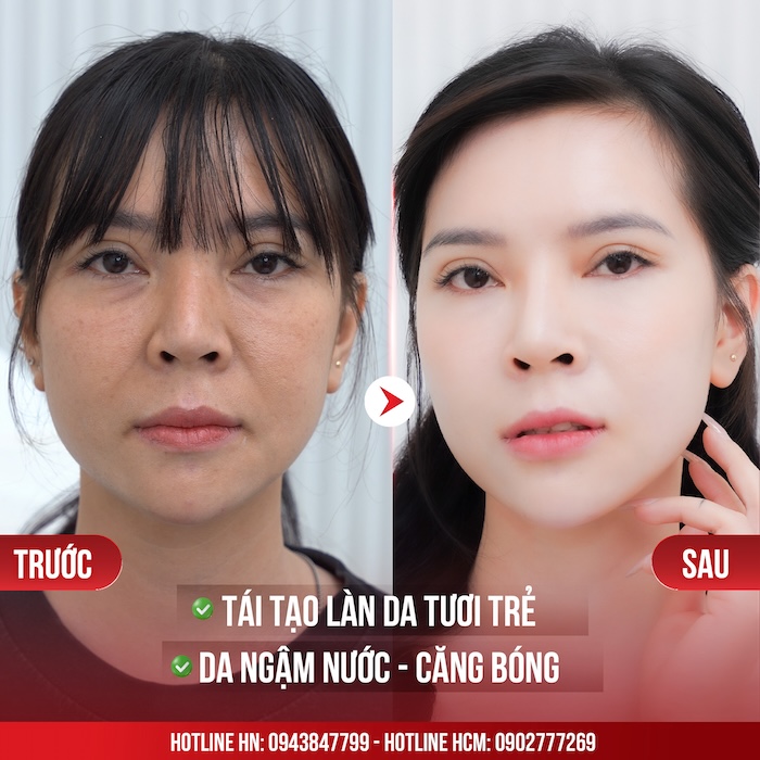 Mặt nạ thiên nhiên trẻ hóa da Mặt nạ thiên nhiên trẻ hóa da