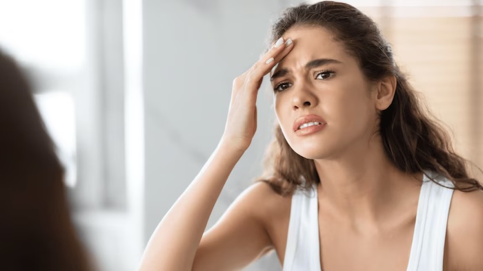 Nếp nhăn chạy thẳng giữa trán Nếp nhăn chạy thẳng giữa trán