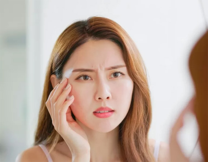 Nếp nhăn giữa 2 lông mày