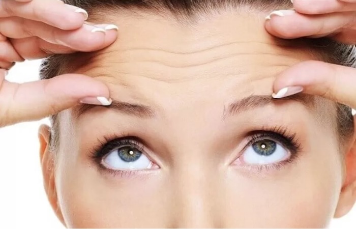 Nếp nhăn ngang trán Nếp nhăn ngang trán