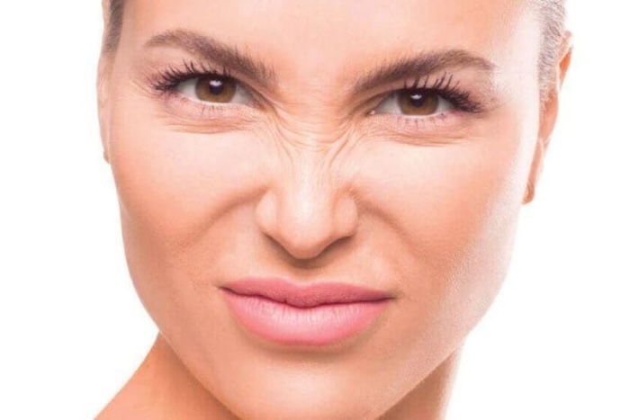 Nếp nhăn ở sống mũi
