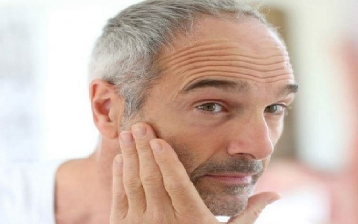 Nếp nhăn trên trán đàn ông Nếp nhăn trên trán đàn ông