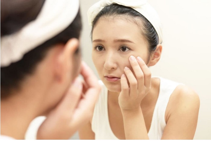 Phụ nữ có nếp nhăn đuôi mắt
