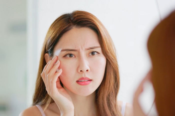 Phụ nữ có nếp nhăn đuôi mắt