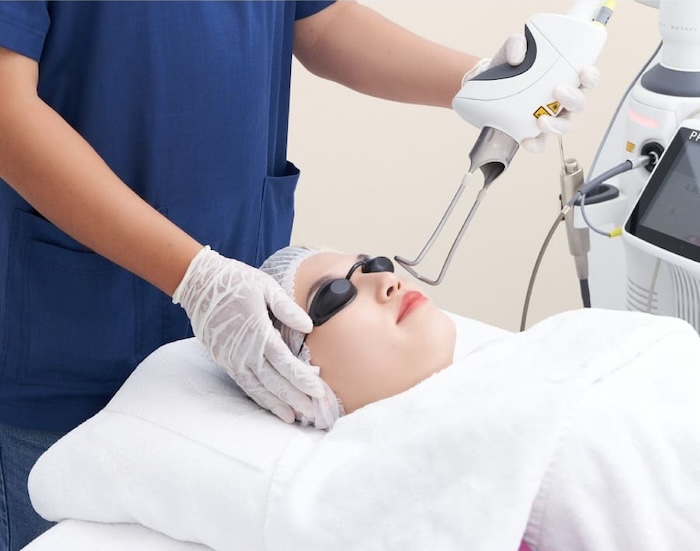 Quy trình trẻ hóa da bằng laser co2