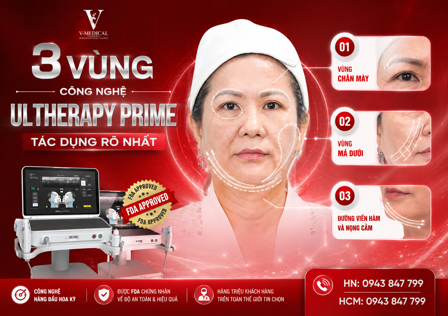 Tác dụng của công nghệ Ultherapy Tác dụng của công nghệ Ultherapy
