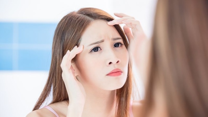 Thuốc trị nhăn trán
