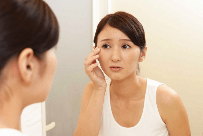 Trán có nhiều nếp nhăn Trán có nhiều nếp nhăn