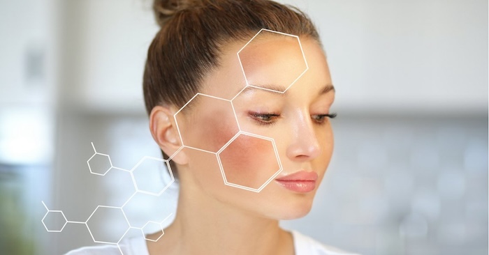 Trẻ hóa da bằng công nghệ ánh sáng ipl