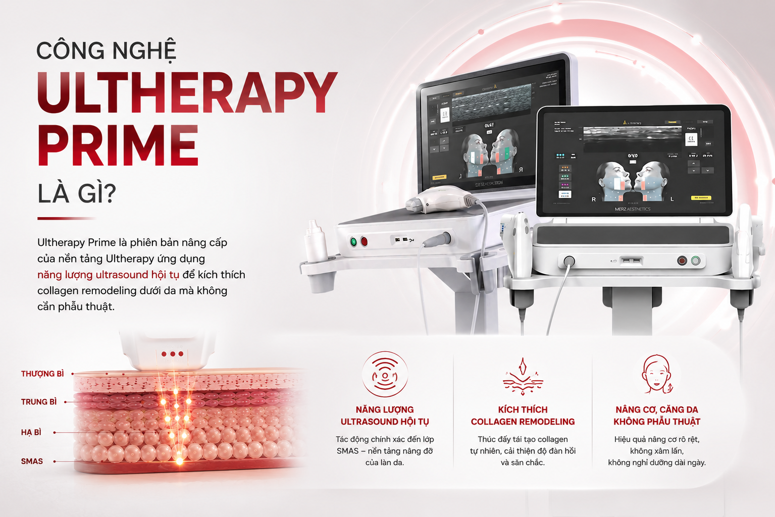 Ultherapy là gì