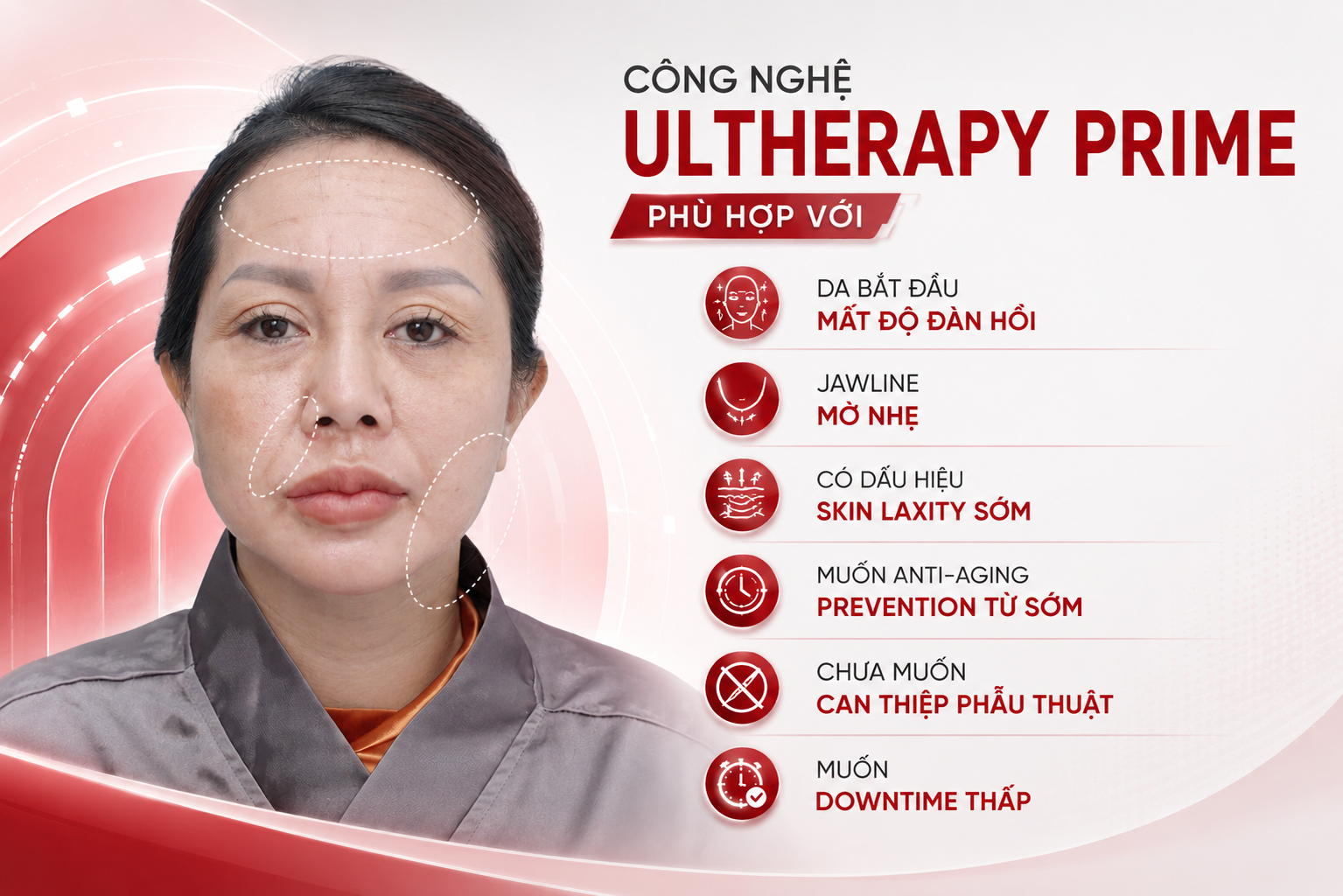 Ultherapy là gì