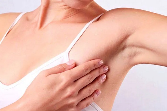 Xóa nếp nhăn ở nách