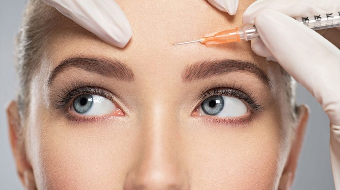 Xóa nhăn trán bằng botox Xóa nhăn trán bằng botox