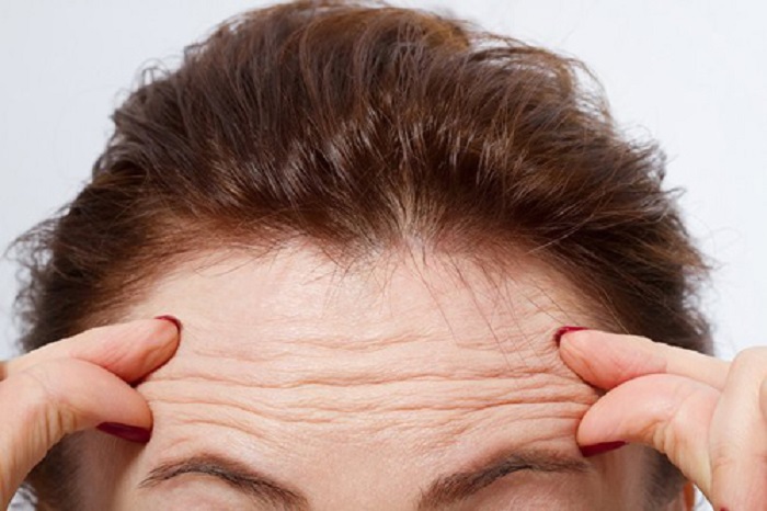 Xuất hiện nếp nhăn trên trán