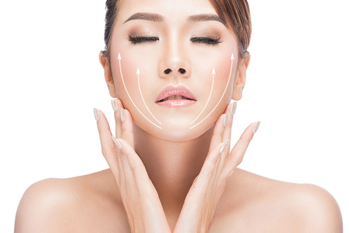Cấy chỉ thon gọn mặt